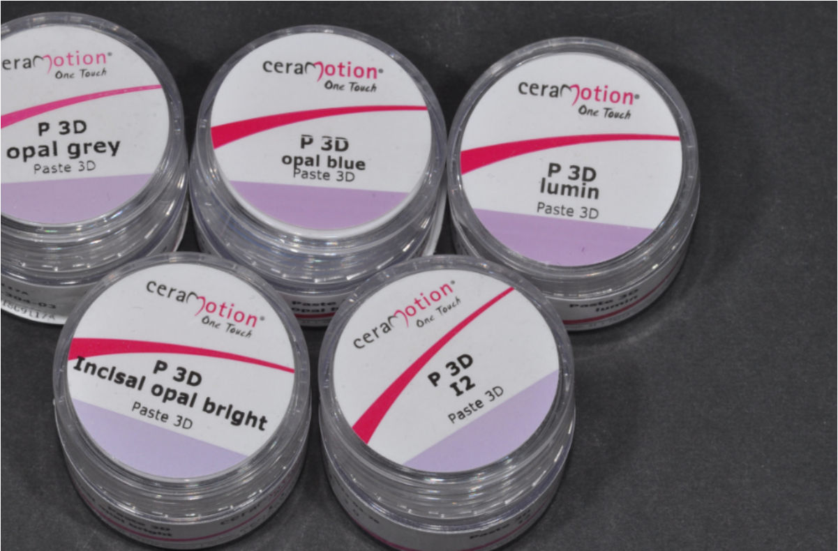 Paste 3D opal e incisal