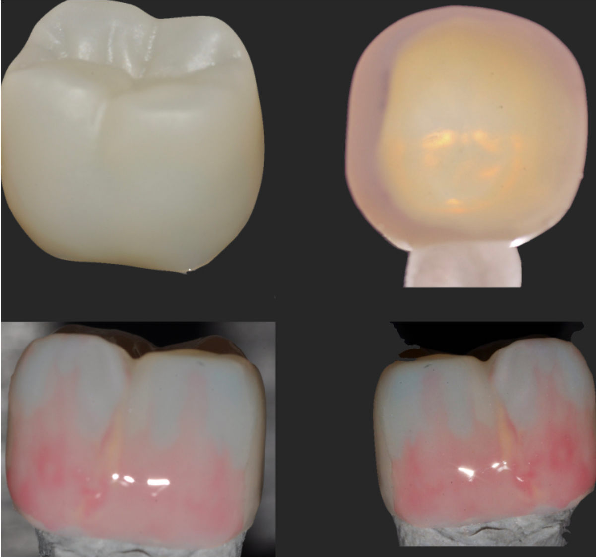 Corone in zirconia durante la finalizzazione